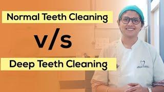 Deep Teeth Cleaning कब क्यू और कैसे करते है?