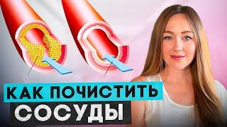 Легкий способ очистить сосуды от атеросклеротической бляшки