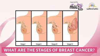 What are the stages of breast cancer