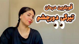 قویترین تکنیک های درمان تیرگی دورچشم که باید بدونید