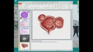 Medical School Pathology 2012 Session 060 Lower Urinary Tract.mp4