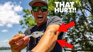 EASIEST HOOK REMOVAL TRICK...I HOOKED MYSELF TO PROVE IT  How to remove a fish hook 