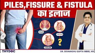 पाइल्स फिशर और फिस्टुला में क्या अंतर है  Piles Fissure & Fistula - कारण लक्षण इलाज