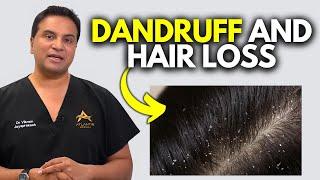 Can Dandruff Cause Hair Loss