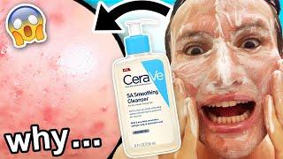 I tried CeraVe SA Cleanser for ONE WEEK I was shocked honey... in tears almost