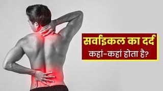 सर्वाइकल का दर्द कहां-कहां होता है?  Cervical pain ke kya lakshan hai