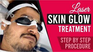 Laser Skin Glow Treatment Step by Step Procedure Video  Sakhiya Skin Clinic