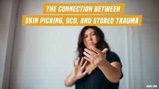 The connection between skin picking OCD and stored trauma