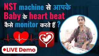 NST Machine से Baby की Heart Beat Monitor कैसे करते है ?  How to Monitor Babys Heartbeat with NST