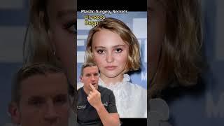 Celebrity Plastic Surgery Secrets Lily Rose Depp