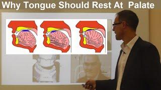 Should Tongue Rest Touch at the Palate Maxilla Roof of the Mouth By Dr Mike Mew