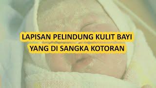 MENGENAL VERNIX PADA KULIT BAYI BARU LAHIR