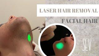 Laser Hair Removal for Facial Hair