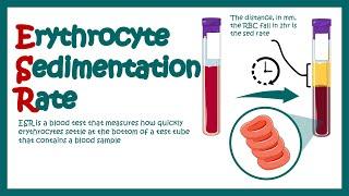 Erythrocyte Sedimentation Rate  ESR  What does ESR test show? What does high ESR means?