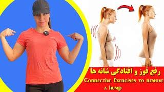 رفع قوز یا افتادگی شانه هاCorrective exercises to remove hump