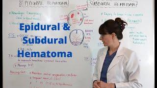 Epidural and Subdural Hematoma