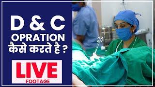 D&C Opration कैसे करते है  Dilatation and curettage D&C क्या होता है  - Dr Asha Gavade