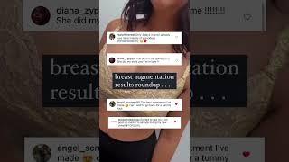 Houston Plastic Surgery Results *Breast Augmentation*