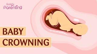 Baby Crowning During Birth - Everything You Need to Know