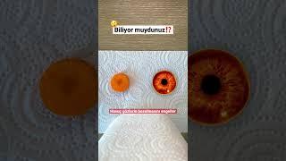 BENZEDİĞİ ORGANA İYİ GELEN YİYECEKLER