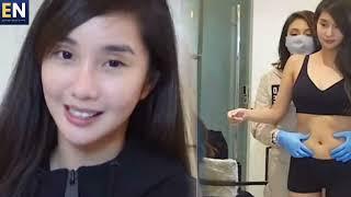 Alodia Gosiengfiao sexy na nagpa-liposuction pa kay Dra. Vicki Belo