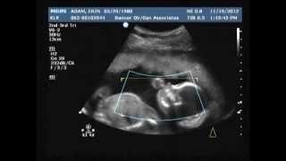 20 week ultrasound.....Its A GIRL