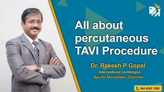 All about percutaneous TAVI Procedure