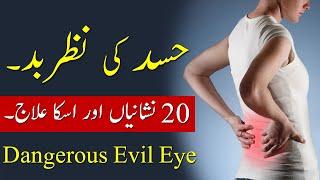 Hasad ki Nazar e Bad 20 Nishaniyan aur iska Illaj Dangerous Evil Eye Symptoms