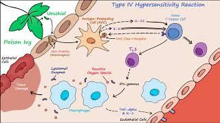 Type IV Hypersensitivity Described Concisely