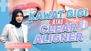 CLEAR ALIGNER APAKAH LEBIH AMAN DARI KAWAT GIGI?