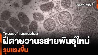 “หมอยง” เผยแนวโน้มฝีดาษวานรสายพันธุ์ใหม่ รุนแรงขึ้น  วันใหม่ ไทยพีบีเอส  22 ส.ค. 67