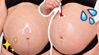 HOW TO PREVENT STRETCH MARKS  PREGNANT BELLY ROUTINE