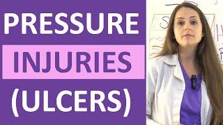 Pressure Ulcers Injuries Stages Prevention Assessment  Stage 1 2 3 4 Unstageable NCLEX