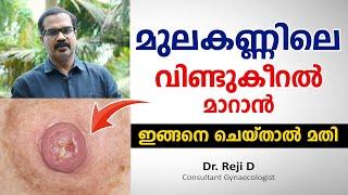 മുലകണ്ണിലെ വിണ്ടുകീറൽ മാറാൻ ഇങ്ങനെ ചെയ്താൽ മതി  Cracked Nipples home remedies  Dr. Reji D