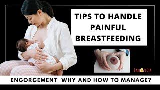 Tips to handle Painful Breastfeeding What is Breast Engorgement and How to handle them ?