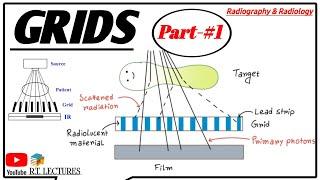 Grids in Radiology  Anti-Scatter Grid  Part -#1  Grid used in radiologyBRTBRIT and DRTDRIT