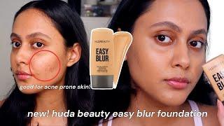 NEW Huda Beauty Easy Blur Foundation Demo & Review on ACNE PRONE & TEXTURED SKIN