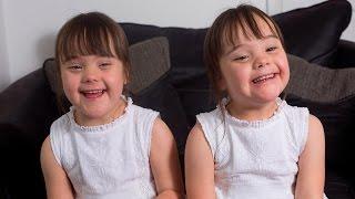 Down’s Syndrome Twins Are One In A Million