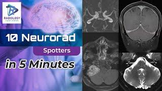 10 Neurorad Spotters in 5 Minutes