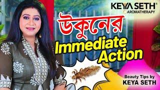 উকুনের immediate action উকুনের দ্রুত সমাধান Tips by Keya Seth