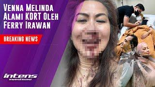 Venna Melinda Alami KDRT Oleh Ferry Irawan