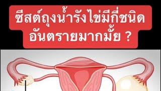 ซีสต์ถุงน้ำรังไข่อันตรายมากมั้ย?