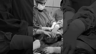 C-section delivery Video #shorts #newvideo