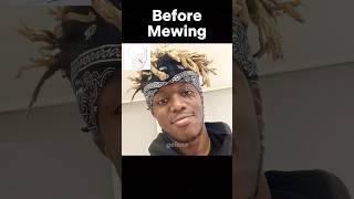 Mewing Transformation