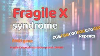 Fragile X syndrome  Genetic disorders  FMR1 gene  CGG repeats  FMRP