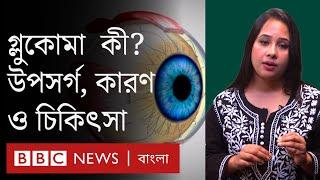 Glaucoma এ চোখের রোগে কোন উপসর্গ ছাড়াই আপনি অন্ধ হয়ে যেতে পারেন  BBC Bangla