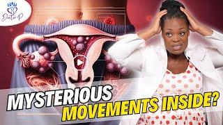 Can You Feel Fibroids Move In Your Stomach