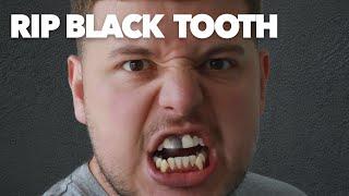 RIP MY BRO’S BLACK TOOTH