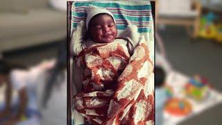 Mother says tongue-tie procedure helped her baby boy