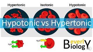 Hypotonic vs Hypertonic Solutions